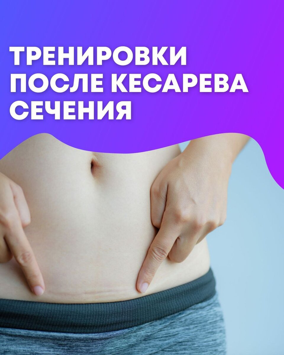 Как делать физические упражнения после кесарева сечения