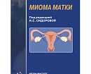 Миома матки - симптомы и лечение