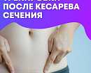 Как делать физические упражнения после кесарева сечения