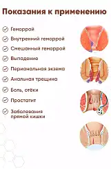 Как лечить геморрой у беременных женщин